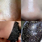 Nose Blackhead Removal Sticker Strips