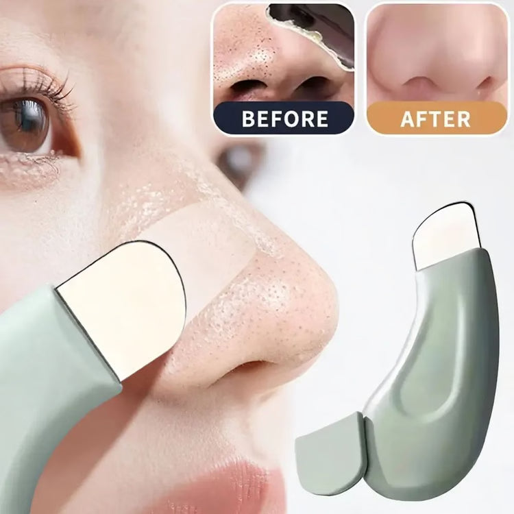 Blackhead & Whitehead Removal Tool for Nose & Face Pore Care