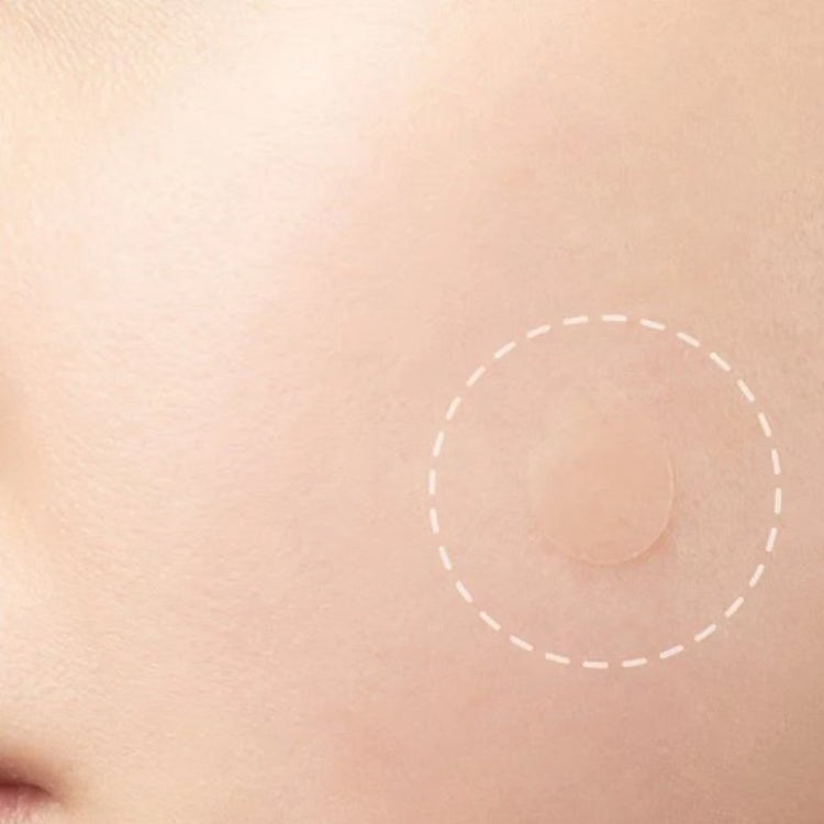 Hydrocolloid Skin Care Patch Kit – Convenient Skin Spot Covering Patches