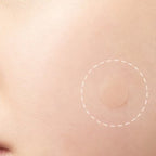Hydrocolloid Skin Care Patch Kit – Convenient Skin Spot Covering Patches